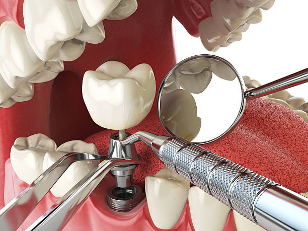 Best Emergency Denture Repair in Prescott, AR